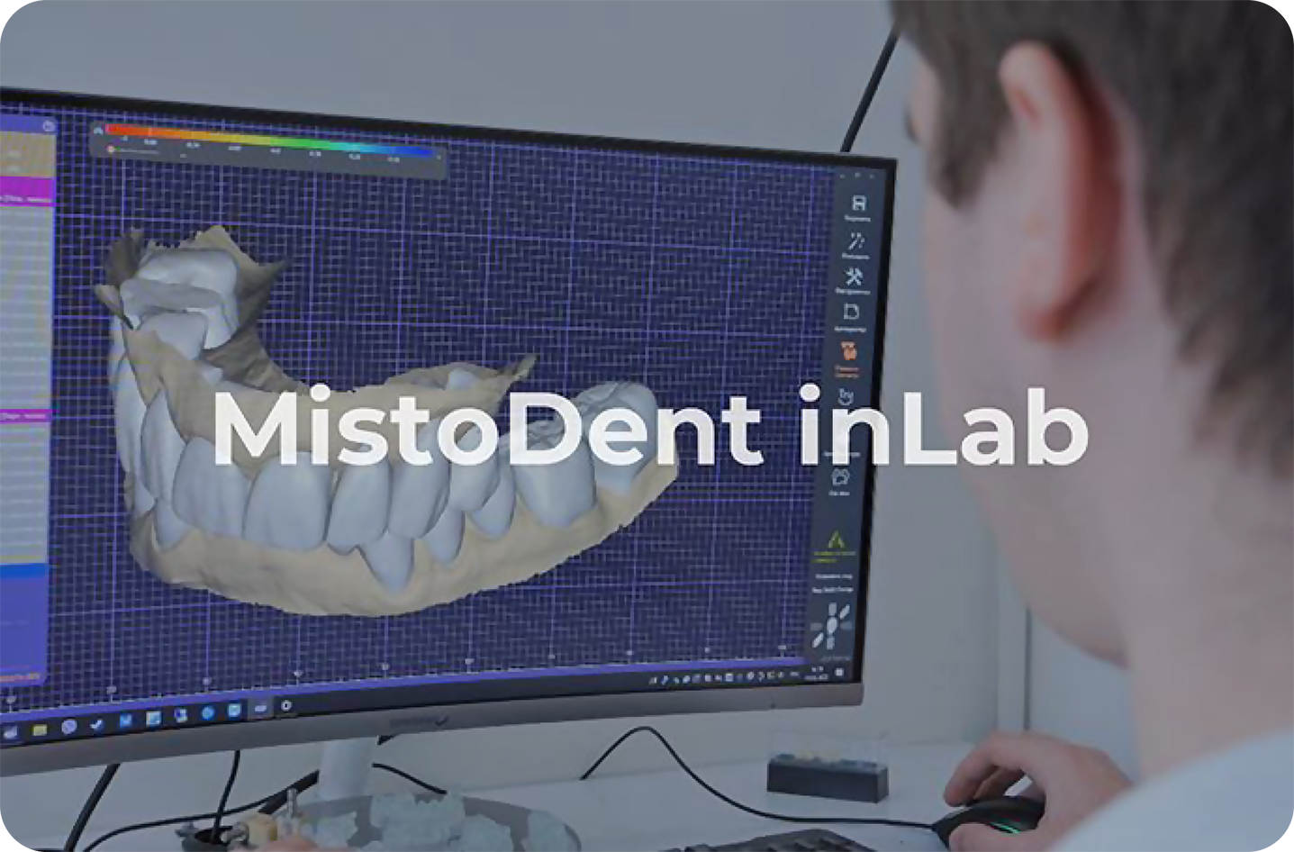 MistoDent InLab